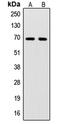 Sentrin-specific protease 2 antibody, LS-C353527, Lifespan Biosciences, Western Blot image 