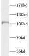 Phosphodiesterase 6A antibody, FNab06257, FineTest, Western Blot image 