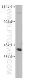 IL-12 antibody, 10213-2-AP, Proteintech Group, Western Blot image 