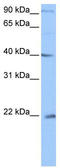 Chromosome 4 Open Reading Frame 33 antibody, TA339995, Origene, Western Blot image 