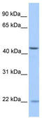 Zinc Finger Protein 485 antibody, TA345524, Origene, Western Blot image 