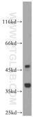TruB Pseudouridine Synthase Family Member 2 antibody, 19891-1-AP, Proteintech Group, Western Blot image 