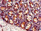 Y+L amino acid transporter 2 antibody, LS-C671816, Lifespan Biosciences, Immunohistochemistry paraffin image 