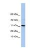 Chromosome 9 Open Reading Frame 153 antibody, NBP1-91452, Novus Biologicals, Western Blot image 