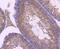 Zinc And Ring Finger 2 antibody, NBP2-67904, Novus Biologicals, Immunohistochemistry paraffin image 