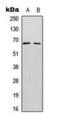 Splicing Factor 1 antibody, orb393160, Biorbyt, Western Blot image 