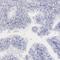 Myoglobin antibody, HPA003123, Atlas Antibodies, Immunohistochemistry frozen image 