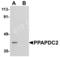 Phospholipid Phosphatase 6 antibody, TA306886, Origene, Western Blot image 