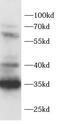 Disintegrin and metalloproteinase domain-containing protein 28 antibody, FNab10453, FineTest, Western Blot image 