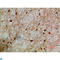 Nuclear factor of activated T-cells 5 antibody, LS-C813913, Lifespan Biosciences, Immunohistochemistry paraffin image 