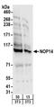 NOP14 Nucleolar Protein antibody, A303-869A, Bethyl Labs, Western Blot image 