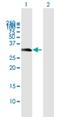 U6 SnRNA Biogenesis Phosphodiesterase 1 antibody, H00079650-B01P, Novus Biologicals, Western Blot image 