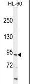 Inter-Alpha-Trypsin Inhibitor Heavy Chain 1 antibody, LS-C165331, Lifespan Biosciences, Western Blot image 