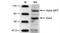Set1/Ash2 histone methyltransferase complex subunit ASH2 antibody, CI1019, Boster Biological Technology, Western Blot image 