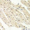 Proteasome Activator Subunit 1 antibody, 19-612, ProSci, Immunohistochemistry paraffin image 