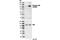Protein Tyrosine Kinase 2 antibody, 3284T, Cell Signaling Technology, Western Blot image 