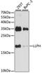 LLP Homolog, Long-Term Synaptic Facilitation Factor antibody, A16117, Boster Biological Technology, Western Blot image 