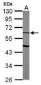 Serpin Family F Member 2 antibody, GTX110076, GeneTex, Western Blot image 