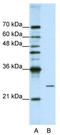 POP4 Homolog, Ribonuclease P/MRP Subunit antibody, TA345980, Origene, Western Blot image 