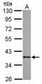SRY-Box 2 antibody, GTX627404, GeneTex, Western Blot image 