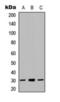 NADH:Ubiquinone Oxidoreductase Core Subunit S3 antibody, orb393118, Biorbyt, Western Blot image 