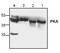 PKACA antibody, PA1-30236, Invitrogen Antibodies, Western Blot image 