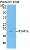 Sucrase-isomaltase, intestinal antibody, LS-C304474, Lifespan Biosciences, Western Blot image 
