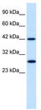 Proteasome 26S Subunit, Non-ATPase 4 antibody, TA330260, Origene, Western Blot image 