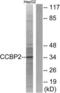 C-C Motif Chemokine Receptor 9 antibody, LS-B8985, Lifespan Biosciences, Western Blot image 