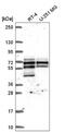Spermatogenesis Associated Serine Rich 2 Like antibody, NBP2-55840, Novus Biologicals, Western Blot image 