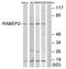 Rabaptin, RAB GTPase Binding Effector Protein 2 antibody, AP33274PU-N, Origene, Western Blot image 