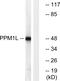 Protein phosphatase 1L antibody, GTX87651, GeneTex, Western Blot image 