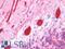 Disabled homolog 1 antibody, LS-B10915, Lifespan Biosciences, Immunohistochemistry paraffin image 