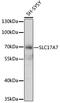 Solute Carrier Family 17 Member 7 antibody, 14-681, ProSci, Western Blot image 
