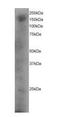 Dedicator of cytokinesis protein 1 antibody, orb18340, Biorbyt, Western Blot image 