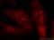 DNA topoisomerase 2-beta antibody, 20549-1-AP, Proteintech Group, Immunofluorescence image 