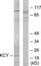 UMP/CMPK antibody, TA312379, Origene, Western Blot image 