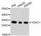 Voltage Dependent Anion Channel 1 antibody, abx125406, Abbexa, Western Blot image 