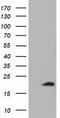 Acireductone Dioxygenase 1 antibody, M07662, Boster Biological Technology, Western Blot image 