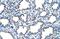 Epithelial membrane protein 2 antibody, GTX47154, GeneTex, Immunohistochemistry paraffin image 