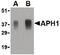 Aph-1 Homolog A, Gamma-Secretase Subunit antibody, PA5-20318, Invitrogen Antibodies, Western Blot image 