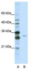 Serine And Arginine Rich Splicing Factor 1 antibody, TA345989, Origene, Western Blot image 