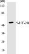 5-Hydroxytryptamine Receptor 2B antibody, LS-C200061, Lifespan Biosciences, Western Blot image 