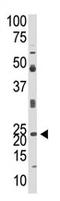 Neurogenin 1 antibody, AP11890PU-N, Origene, Western Blot image 