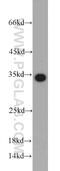 Eukaryotic Translation Elongation Factor 1 Beta 2 antibody, 10483-1-AP, Proteintech Group, Western Blot image 