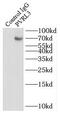 Nectin Cell Adhesion Molecule 3 antibody, FNab06961, FineTest, Immunoprecipitation image 