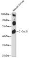 Glycoprotein-N-acetylgalactosamine 3-beta-galactosyltransferase 1 antibody, 14-673, ProSci, Western Blot image 