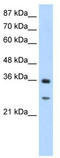 GIPC PDZ Domain Containing Family Member 2 antibody, TA344075, Origene, Western Blot image 