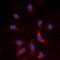 SMAD Family Member 3 antibody, LS-C368536, Lifespan Biosciences, Immunofluorescence image 