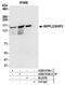 Phosphatidylinositol-3,4,5-trisphosphate 5-phosphatase 2 antibody, A300-574A, Bethyl Labs, Immunoprecipitation image 